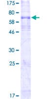 Human EDNRB / Endothelin B Receptor Protein (Recombinant GST)