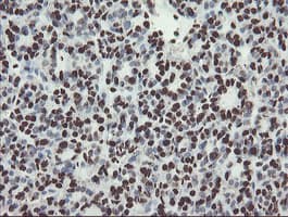 NONO / P54NRB Antibody (clone OTI2C9)