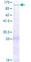 Human DUS3L Protein (Recombinant GST)