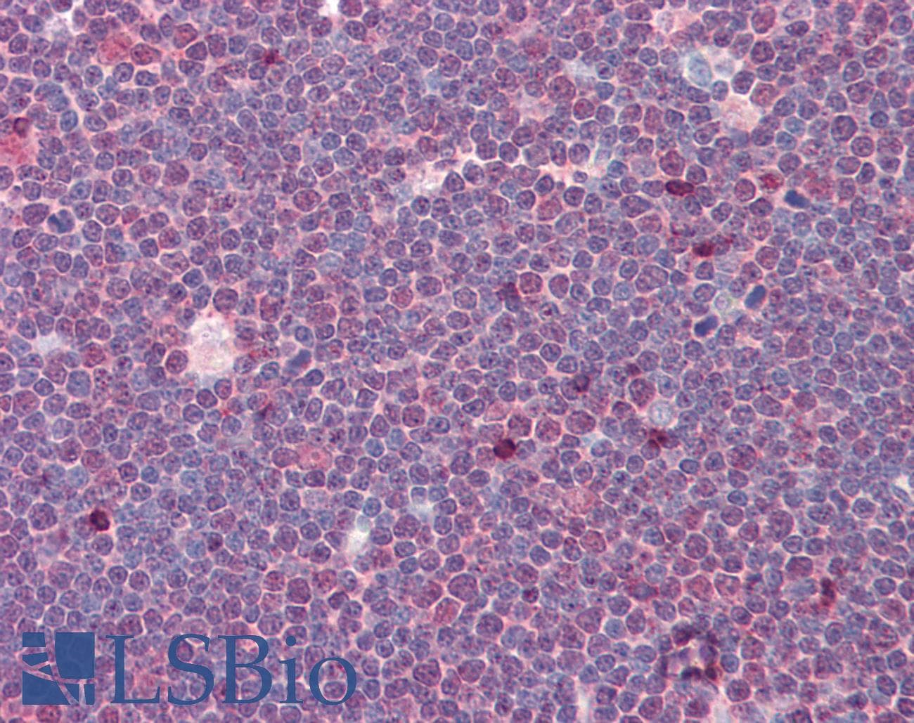IHC-plus™ Treacle / TCOF1 Antibody (aa41-90)