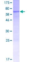 Human ARHGEF16 Protein (Recombinant GST)