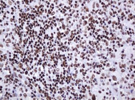 DCPS Antibody (clone OTI4H8)