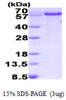 Human PPIL2 / CYP60 Protein (Recombinant His)