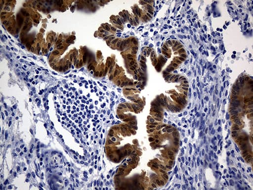 ASL / Argininosuccinate Lyase Antibody (clone OTI9G2, Carrier-free)