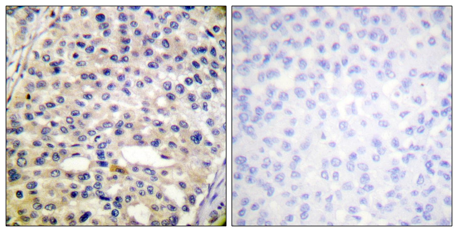Vimentin Antibody (phospho-Ser56)