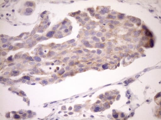 EIF3D Antibody (clone OTI14D6)