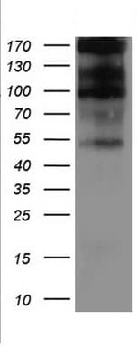 CD30 Antibody (aa408-595, clone UMAB256, Carrier-free)
