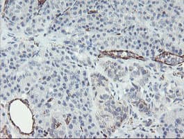 Monoclonal Mouse anti-Human PECAM-1 / CD31 Antibody (clone OTI1C2, IHC, WB)