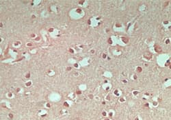 MAP1LC3A / LC3A Antibody (aa1-50)