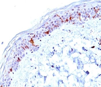 CD1A Antibody (clone O10, Ready-to-Use)