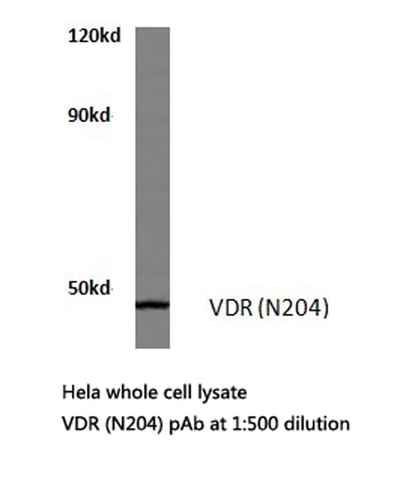 Vitamin D Receptor / VDR Antibody (Asn204)
