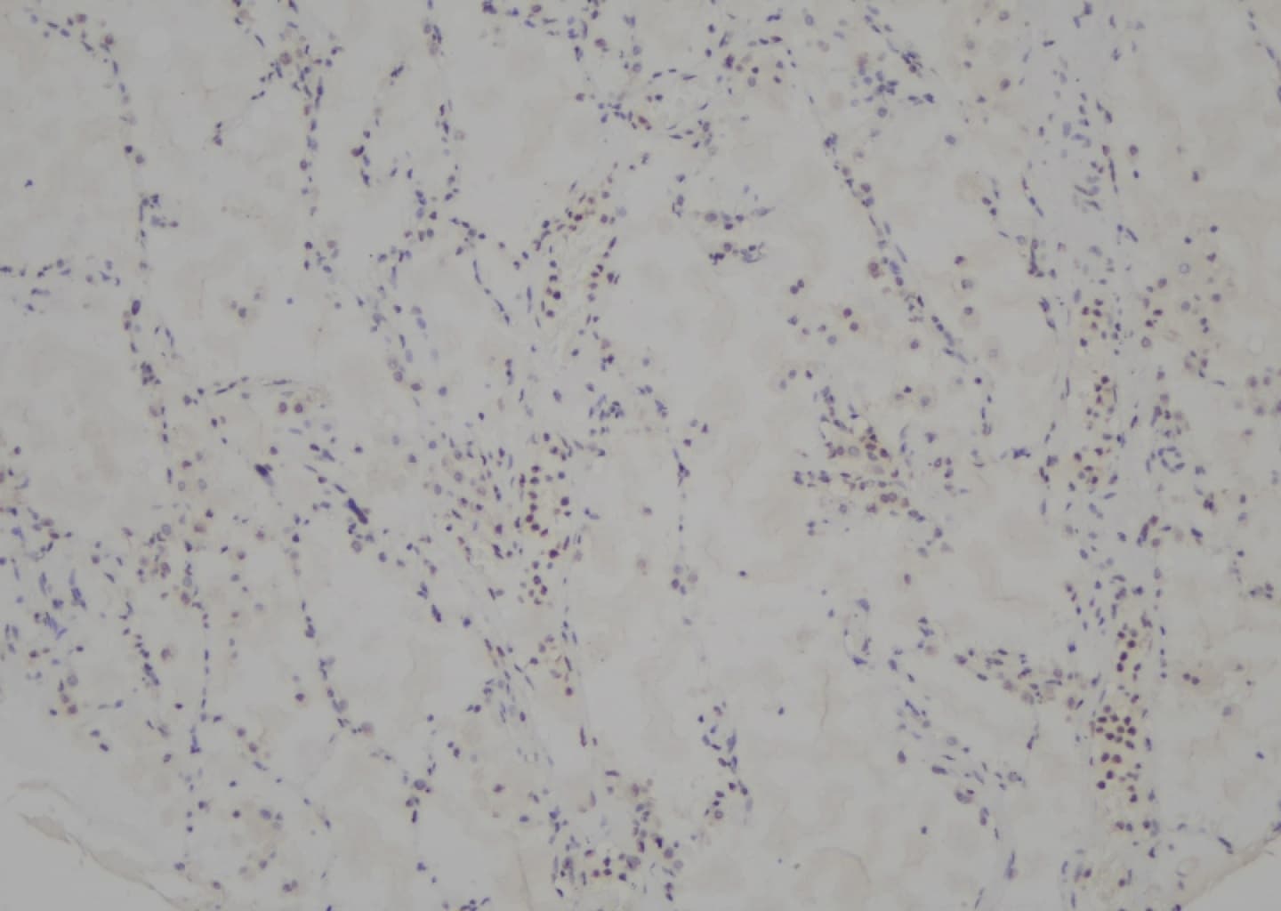 Polyclonal Rabbit anti-Human DDIT3 / CHOP Antibody (IHC, IF, WB)