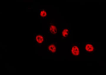 CSRNP2 / FAM130A1 Antibody