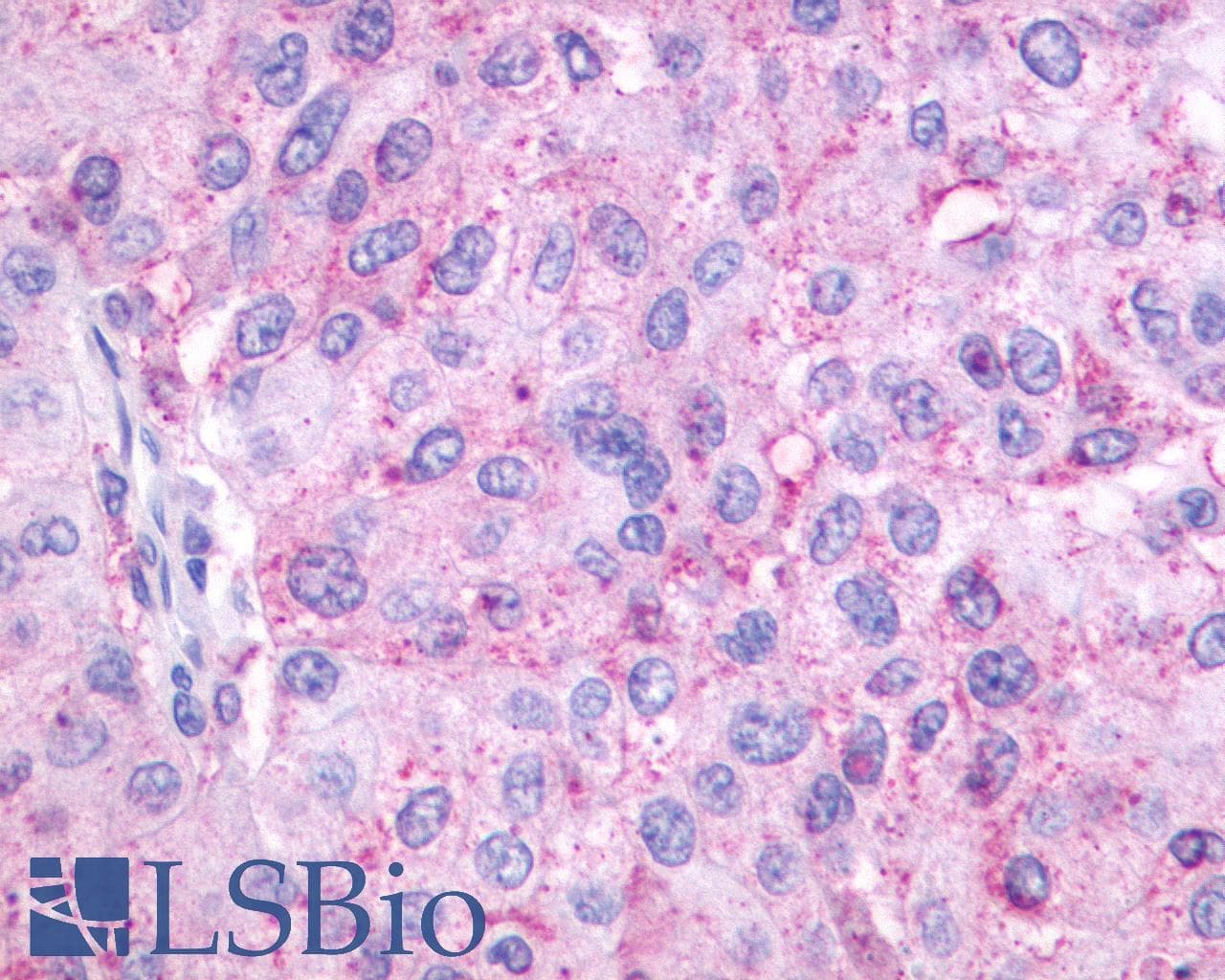 PathPlus™ OXER1 Antibody (C-Terminus)