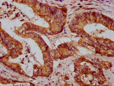ZDHHC14 Antibody