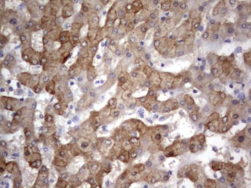 Monoclonal Rat anti-Human Acidic Cytokeratin Antibody (clone 2G10, IHC)