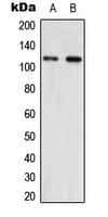NNT Antibody (Internal)