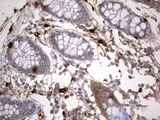 Monoclonal Mouse anti-Human SMPD1 / Acid Sphingomyelinase Antibody (clone OTI3H7, aa62-341, IHC, WB)