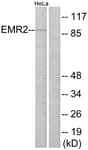 ADGRE2 / EMR2 Antibody (aa121-170)