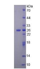 Human PH / PAH Protein (Recombinant His)
