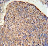 Polyclonal Rabbit anti-Human CCDC130 Antibody (aa173-200, IHC, WB)