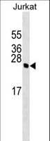 HMGB4 Antibody (aa45-73)