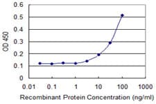 Monoclonal Mouse anti-Human SEPT1 / Septin 1 Antibody (clone 1F12, IF, WB)