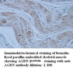 Polyclonal Rabbit anti-Human AGRN / Agrin Antibody (N-Terminus, IHC)