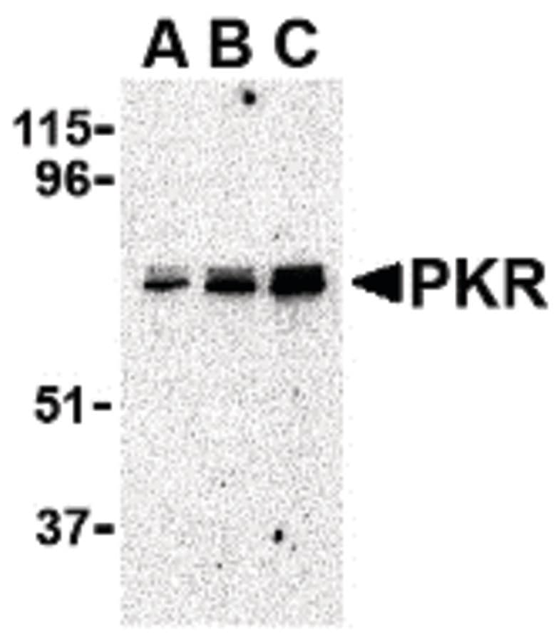 IHC-plus™ EIF2AK2 / PKR Antibody