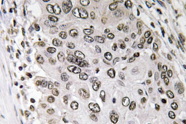 ANXA3 / Annexin A3 Antibody (Tyr64)