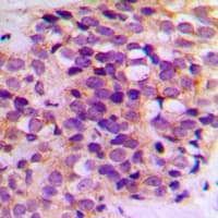 BCL2 / Bcl-2 Antibody (Internal)