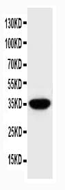 Polyclonal Rabbit anti-Human Osteonectin / SPARC Antibody (aa284-303, IHC, WB)