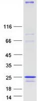 Human NINJ2 / Ninjurin 2 Protein (Recombinant Myc-DDK (Flag))