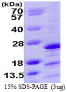 Human NDUFAF2 / NDUFA12L Protein (Recombinant His)