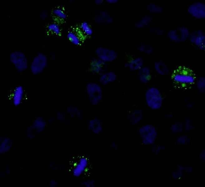 Polyclonal Rabbit anti-Human CDK5RAP2 Antibody (aa1843-C-term, IF)