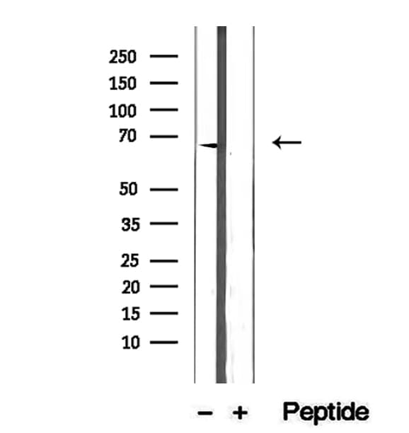 ETFDH Antibody