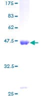 Human NCS1 / Neuronal Calcium Sensor Protein (Recombinant GST)