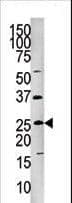 FADD Antibody (phospho-Ser191)