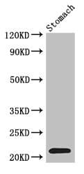 IHC-plus™ IFNA2 / Interferon Alpha 2 Antibody