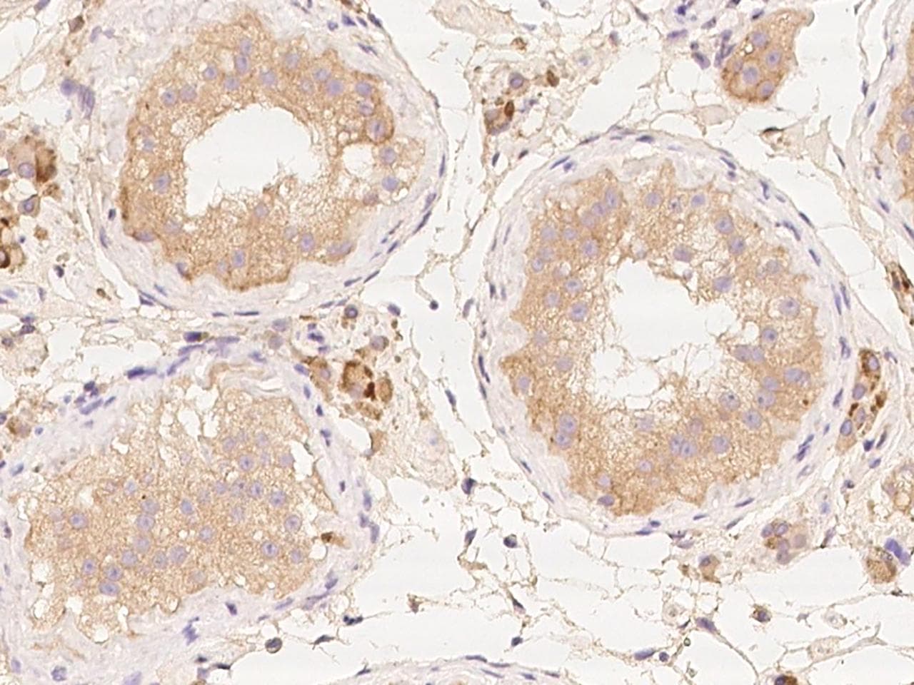 ZNF101 Antibody
