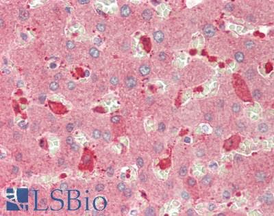 IHC-plus™ Polyclonal Rabbit anti-Human CCN5 Antibody (IHC, WB)
