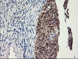 LPL / Lipoprotein Lipase Antibody (clone OTI3A10)
