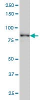 ERIC-1 / TACC3 Antibody (clone 6C4)