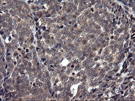 TXNDC5 / ERP46 Antibody (clone OTI2E6)