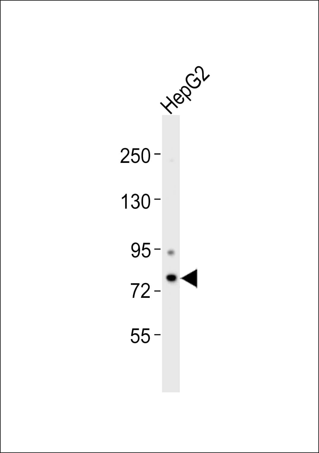 Polyclonal Rabbit anti-Human CHML Antibody (WB)