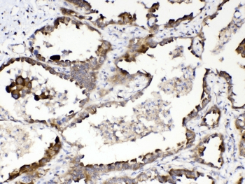 RANBP1 Antibody
