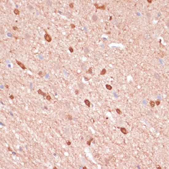 Polyclonal Rabbit anti-Human ACAT2 Antibody (IHC, IF)