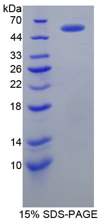 Human FGB / Fibrinogen Beta Chain Protein (Recombinant His-S)