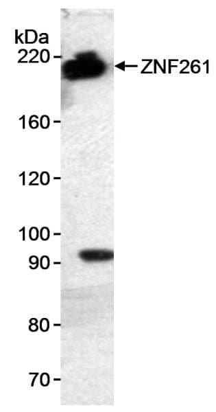 Polyclonal Rabbit anti-Human ZMYM3 Antibody (aa250-300, IHC, WB)