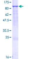 Human ABCF2 Protein (Recombinant GST)
